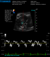 Live cell imaging