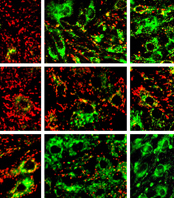 Live cell imaging