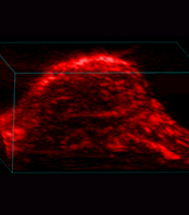 Live cell imaging