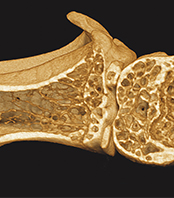 X-ray and micro computed tomography