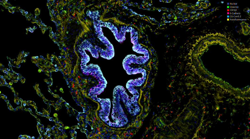 Orion 2024 AACR poster: 17-plex single-step stain and imaging of cell Lung Carcinoma