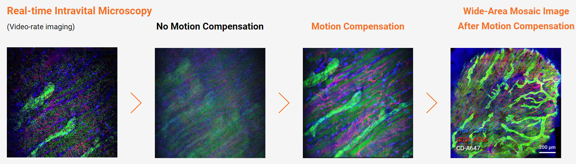 IVIM Technology-Integrated Motion Artifact Compensation